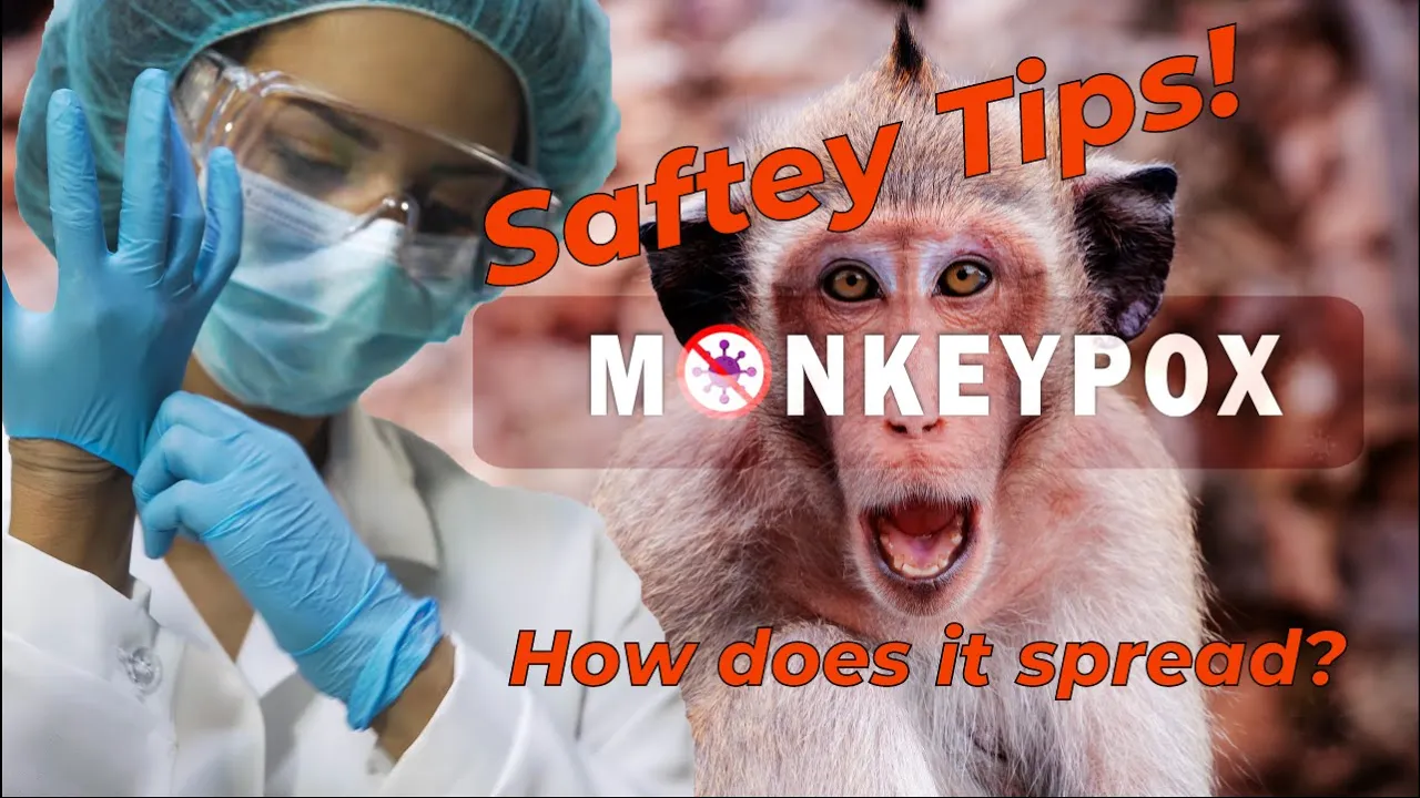 Monkeypox safety tips and how the virus spreads